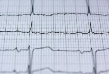 quantum node apex pulse